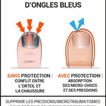 Epitact - Protections ongles bleus - Le coureur nordique